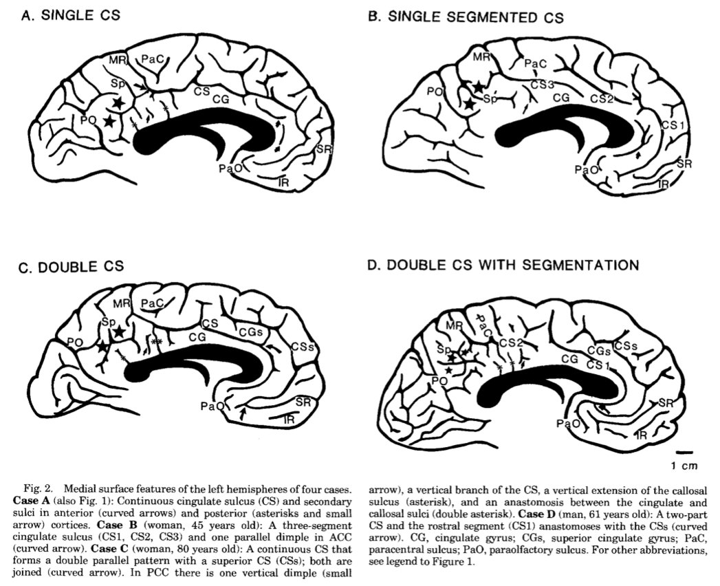 Cingulate Sulcus